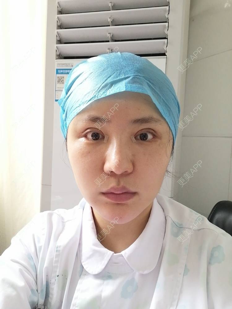 更美 - 静静子子的鼻部多项经验 | 鼻部多项 | 首尔