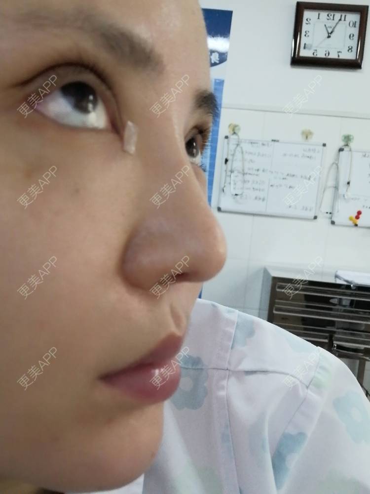 更美 - 静静子子的鼻部多项经验 | 鼻部多项 | 首尔