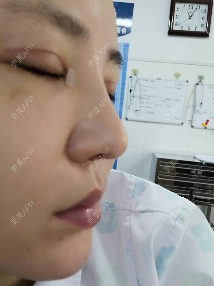 更美 - 静静子子的鼻部多项经验 | 鼻部多项 | 首尔