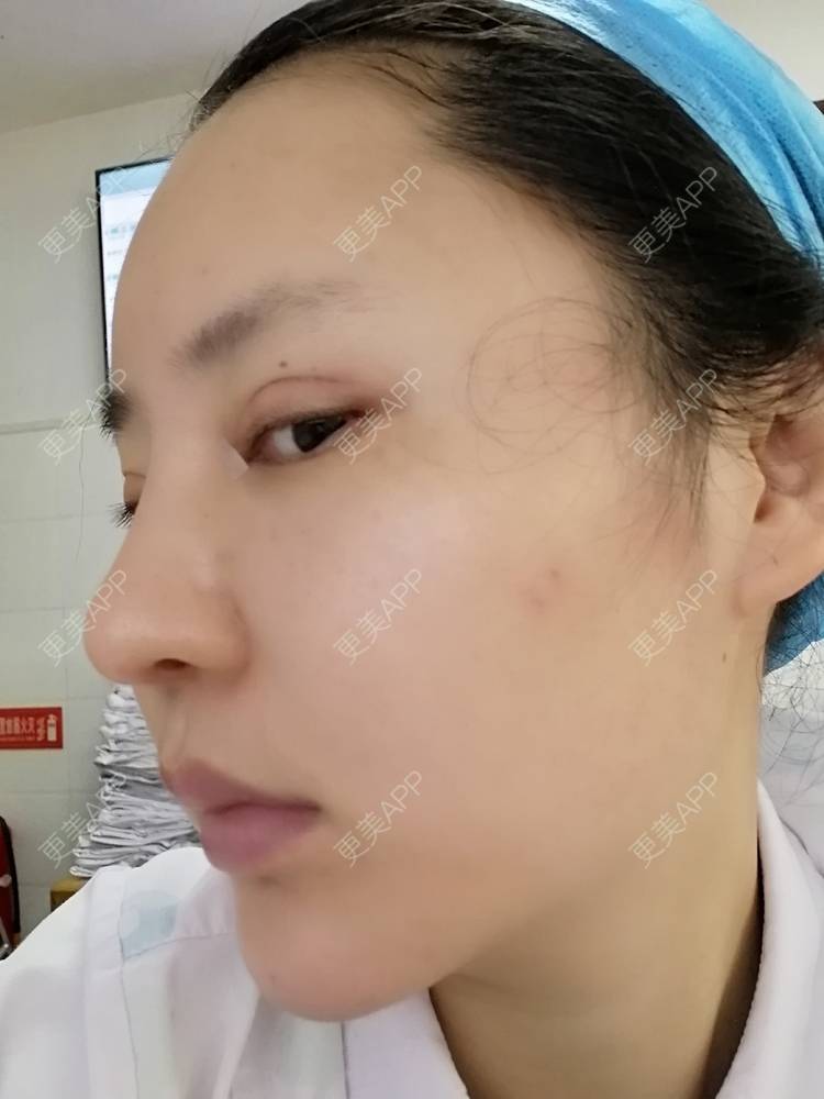 更美 - 静静子子的鼻部多项经验 | 鼻部多项 | 首尔