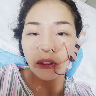 更美用户XFxqGjA00s