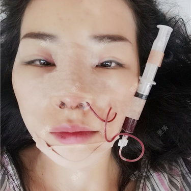 更美用户XFxqGjA00s