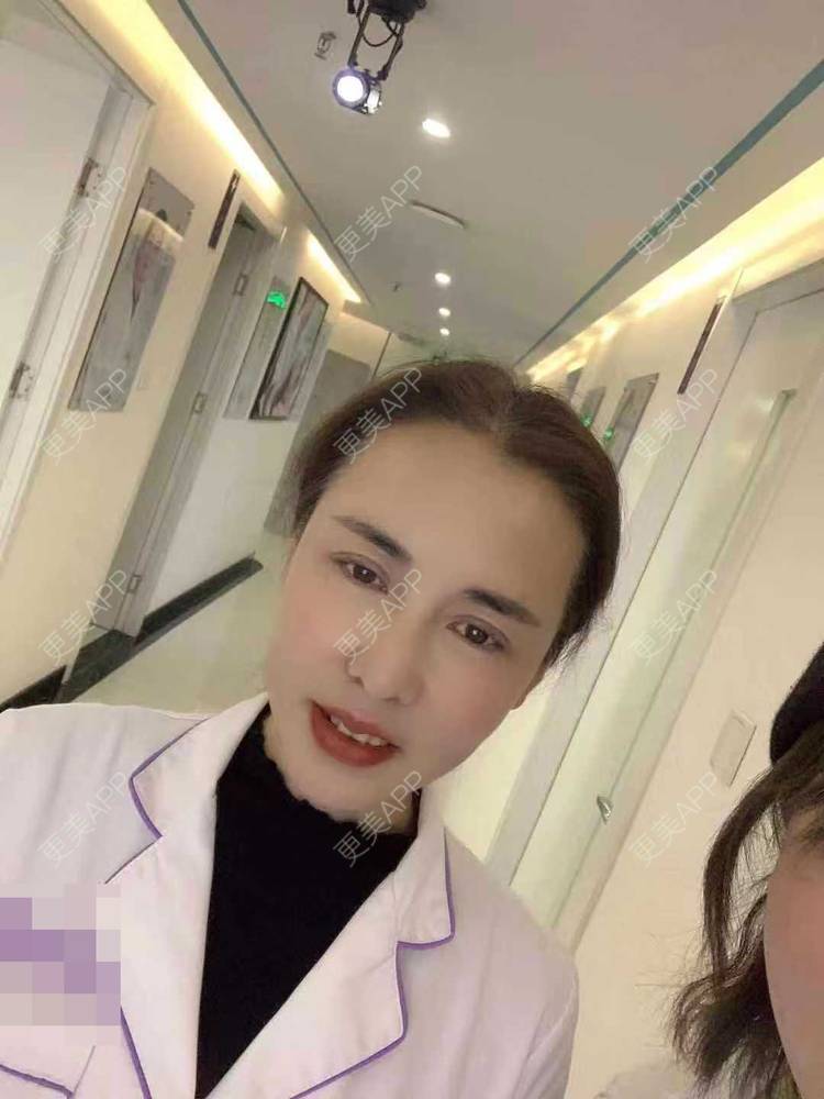 更美 - 更美用户v5N4yRtiJx的提眉修复经验 | 提眉修复 | 郑州