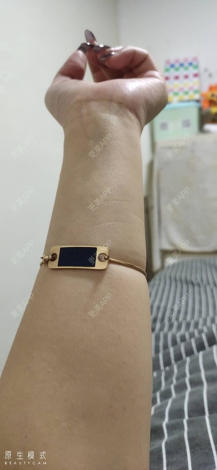 更美 - 🎃Nicky💒💋的美白嫩肤经验 | 手臂脱毛 | 美白嫩肤 | 广州