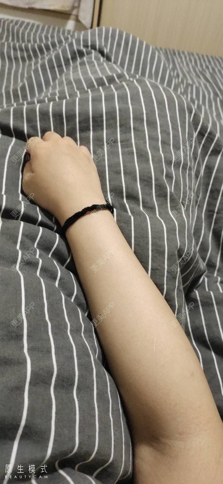 更美 - 🎃Nicky💒💋的美白嫩肤经验 | 手臂脱毛 | 美白嫩肤 | 广州