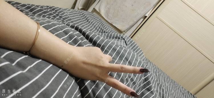 更美 - 🎃Nicky💒💋的手臂脱毛经验 | 手臂脱毛 | 广州