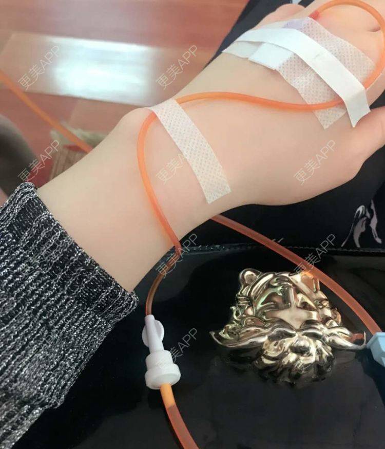 更美用户gcwfvc2ig7的注射美白日记