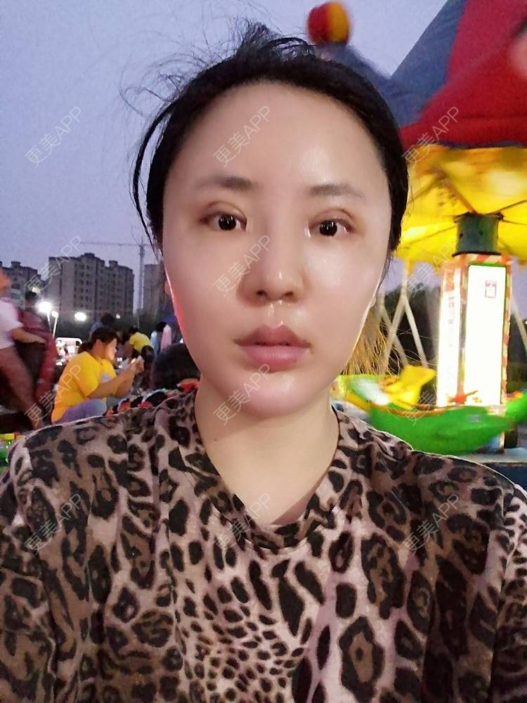 更美 - 静静子子的鼻部多项经验 | 鼻部多项 | 首尔