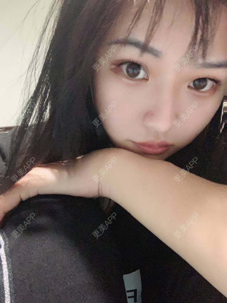 更美 - 虽醉尤醒的激光洗眉经验 | 上海 | 激光洗眉