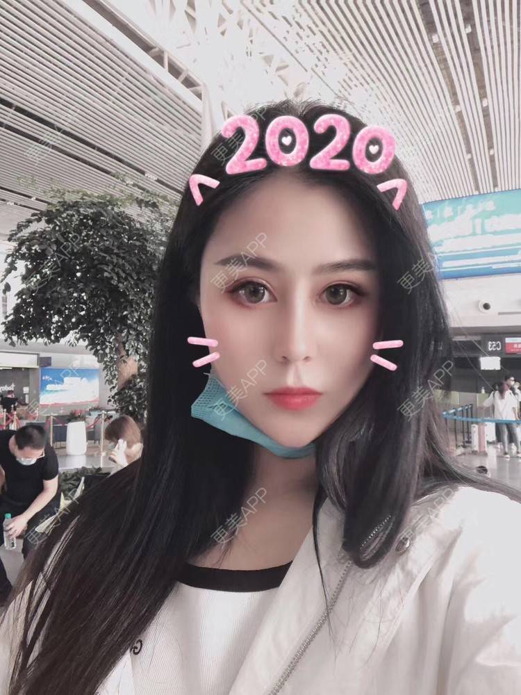 更美 - 更美用户zwQN5e8jIh的鼻部多项经验 | 鼻部多项 | 长沙