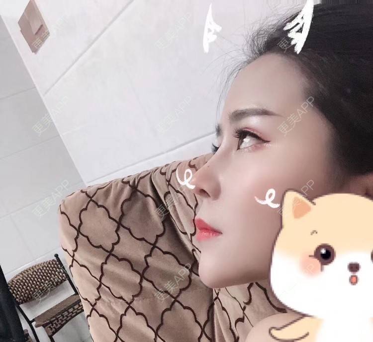 更美 - 更美用户zwQN5e8jIh的鼻部多项经验 | 鼻部多项 | 长沙