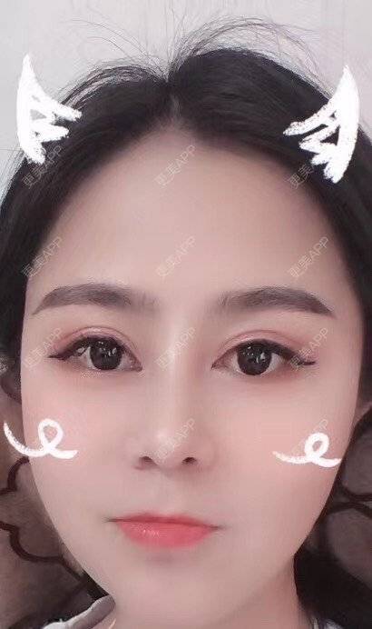 更美 - 更美用户zwQN5e8jIh的鼻部多项经验 | 鼻部多项 | 长沙