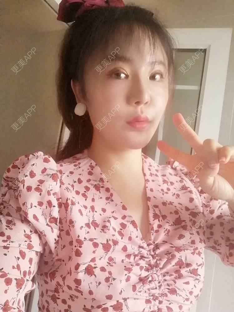 更美 - 静静子子的鼻部多项经验 | 视频日记 | 鼻部多项 | 首尔