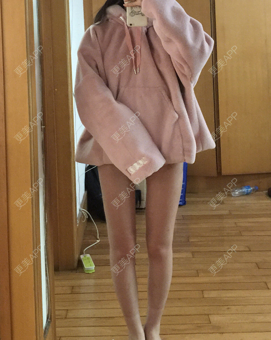 更美用户gjffylxqhk的吸脂瘦大腿日记