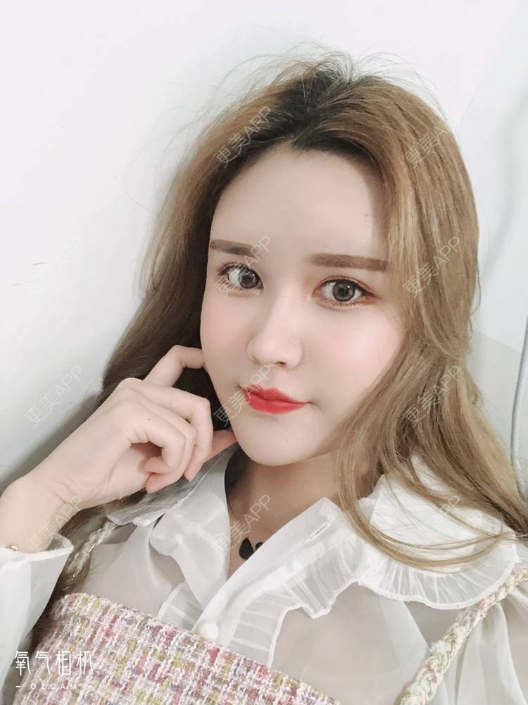 更美 - 更美用户THBdLsb5f0的膨体垫眉弓经验 | 膨体垫眉弓 | 深圳