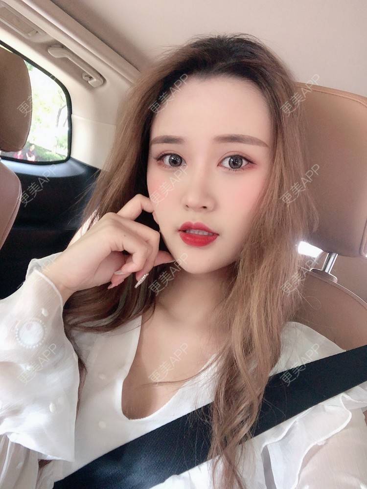 更美 - 更美用户THBdLsb5f0的膨体垫眉弓经验 | 膨体垫眉弓 | 深圳