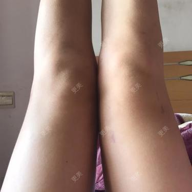 更美用户P3NzNvpla1