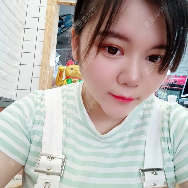 更美 - sonder.的下巴经验 | 下巴 | 硅胶垫下巴 | 长沙 | 视频日记