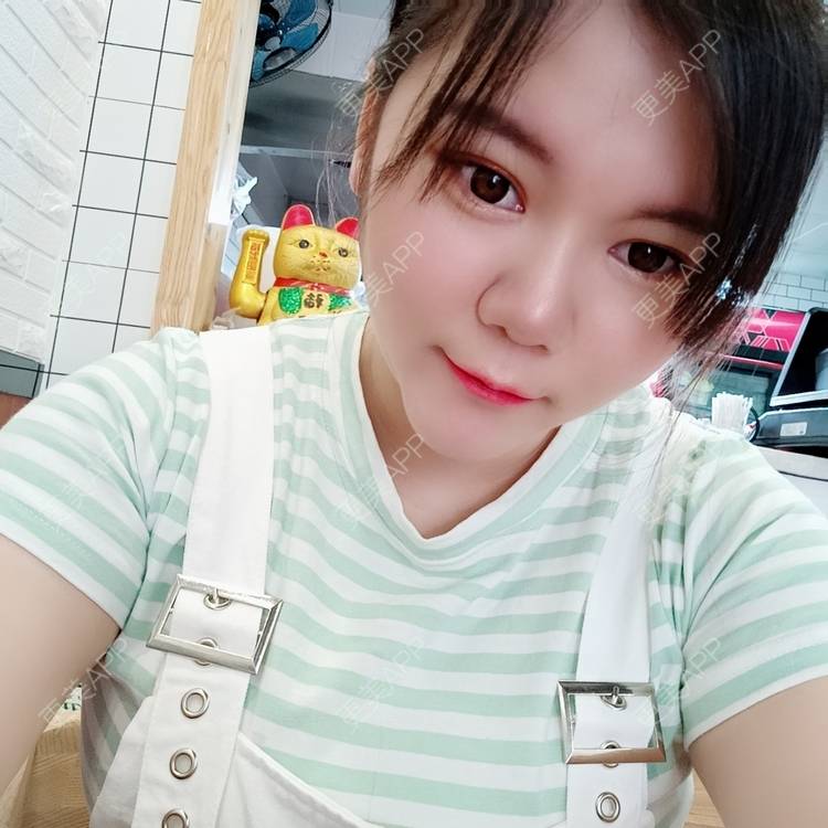 更美 - sonder.的下巴经验 | 下巴 | 硅胶垫下巴 | 长沙 | 视频日记