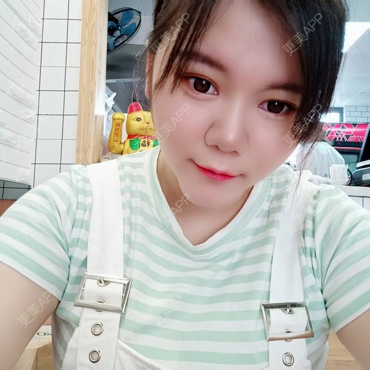 更美 - sonder.的下巴经验 | 下巴 | 硅胶垫下巴 | 长沙 | 视频日记