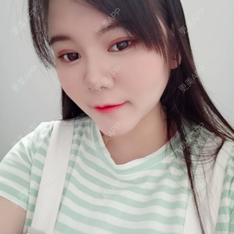 更美 - sonder.的下巴经验 | 下巴 | 硅胶垫下巴 | 长沙 | 视频日记