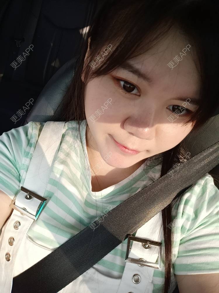 更美 - sonder.的下巴经验 | 下巴 | 硅胶垫下巴 | 长沙 | 视频日记