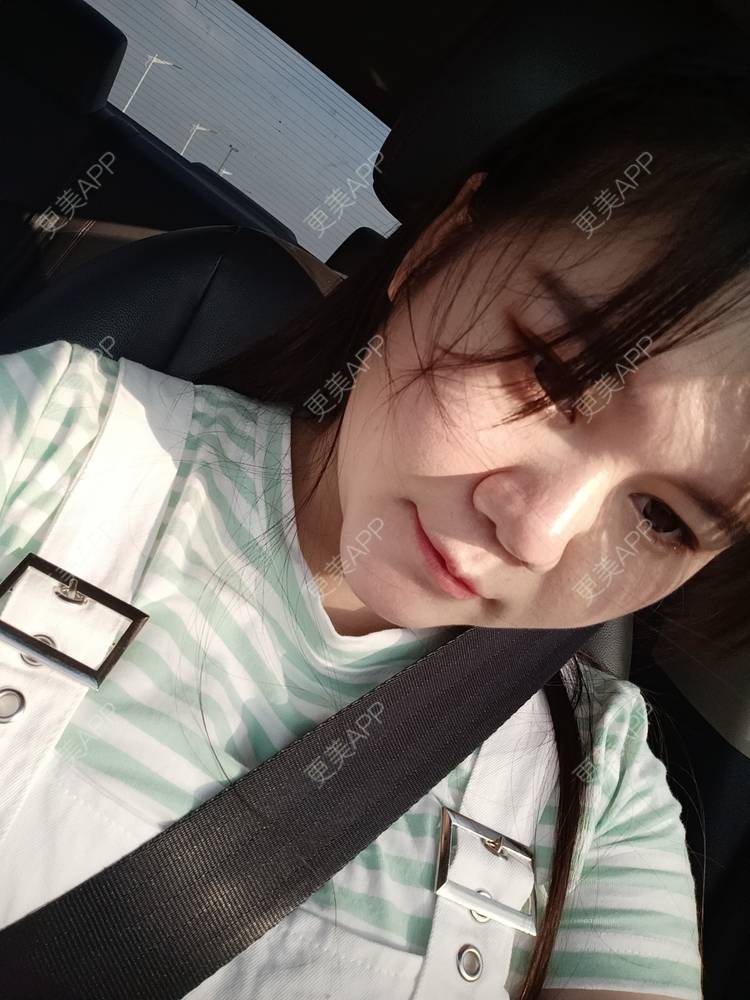 更美 - sonder.的下巴经验 | 下巴 | 硅胶垫下巴 | 长沙 | 视频日记