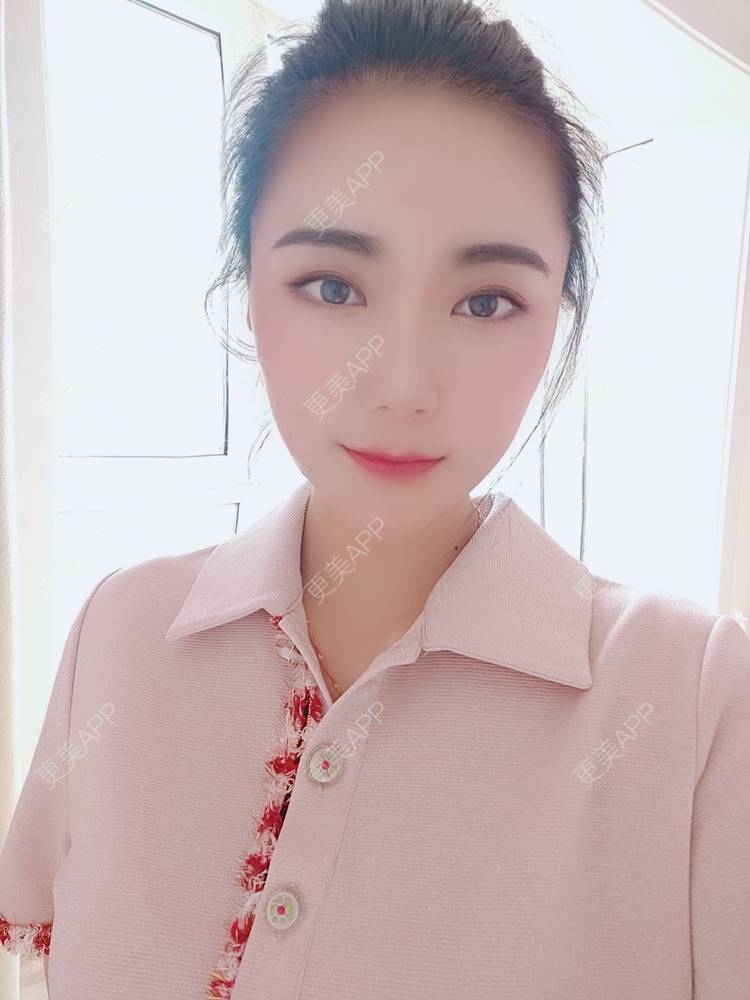 更美 - 更美魔女的埋线提升经验 | 埋线提升 | 郑州