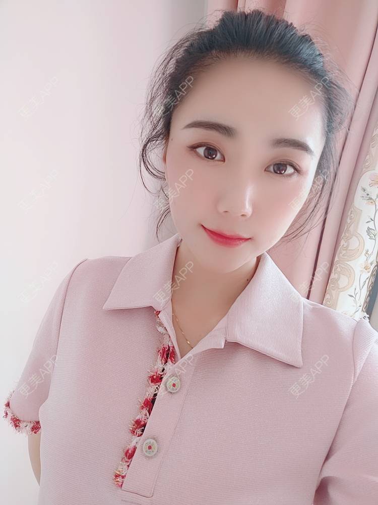 更美 - 更美魔女的埋线提升经验 | 埋线提升 | 郑州