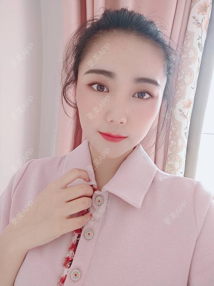 更美 - 更美魔女的埋线提升经验 | 埋线提升 | 郑州