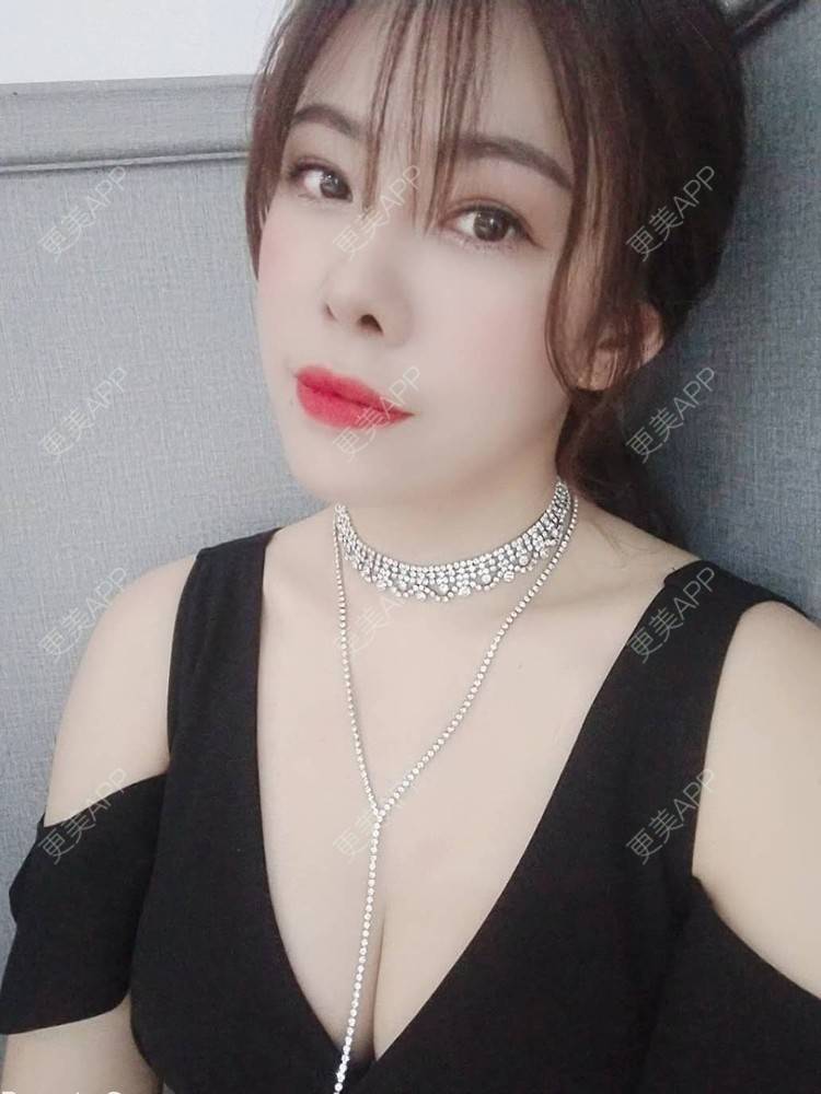 更美 - 琵琶弦的自体脂肪填充泪沟经验 | 自体脂肪丰面颊 | 自体脂肪丰唇 | 自体脂肪丰苹果肌 | 自体脂肪填充泪沟 | 自体脂肪隆鼻 | 自体脂肪垫下巴 | 自体脂肪丰太阳穴 | 自体脂肪丰额头 | 自体脂肪全面部填充 | 自体脂肪面部填充