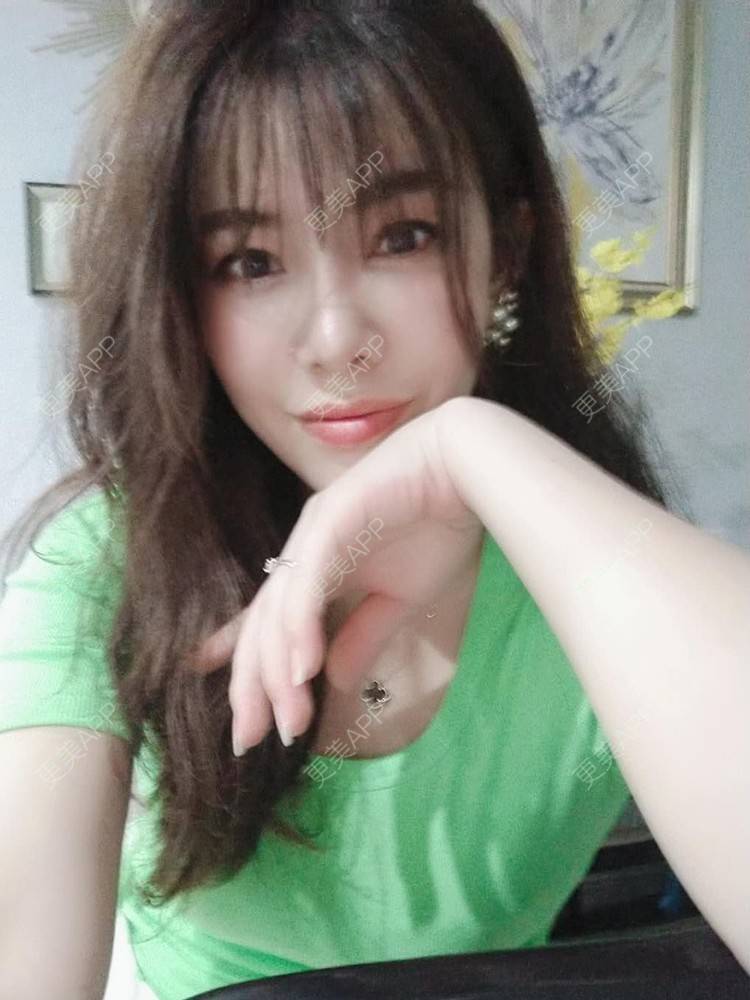 更美 - 琵琶弦的自体脂肪填充泪沟经验 | 自体脂肪丰面颊 | 自体脂肪丰唇 | 自体脂肪丰苹果肌 | 自体脂肪填充泪沟 | 自体脂肪隆鼻 | 自体脂肪垫下巴 | 自体脂肪丰太阳穴 | 自体脂肪丰额头 | 自体脂肪全面部填充 | 自体脂肪面部填充