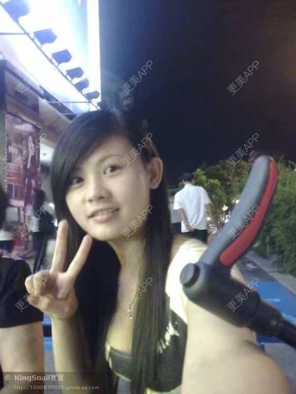 更美 - 果敢柠檬精的鼻部多项经验 | 耳软骨隆鼻 | 鼻部多项 | 鼻中隔软骨垫鼻头 | 鼻小柱延长 | 自体软骨垫鼻尖 | 中山