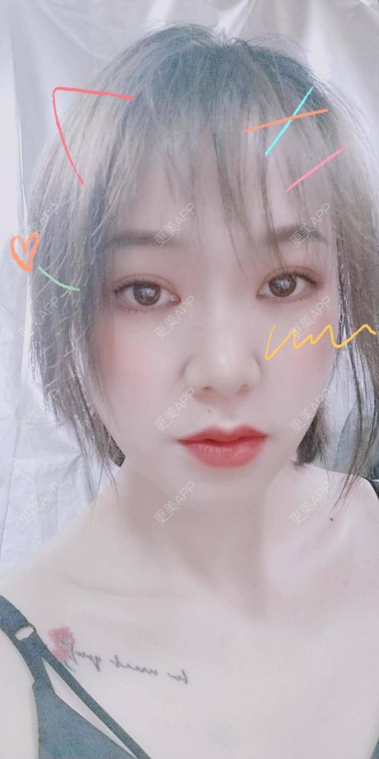 更美 - 爱笑的菇凉zero的开外眼角经验 | 上海 | 开外眼角