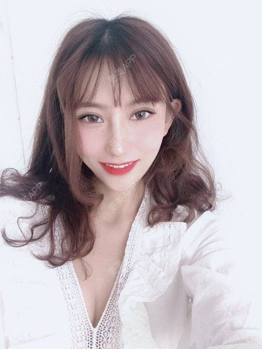 更美 - 更美用户oC0pDiCHx0的鼻部多项经验 | 鼻部多项 | 肋软骨隆鼻 | 假体垫鼻基底 | 长鼻矫正