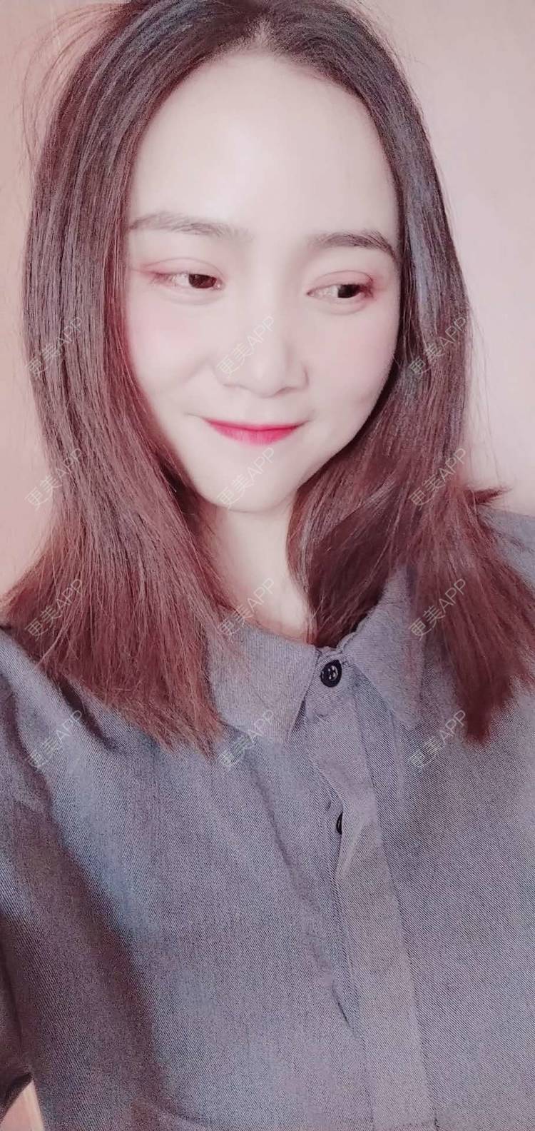 更美 - 更美用户222hTxLwTH的自体脂肪丰卧蚕经验 | 上海 | 自体脂肪丰卧蚕