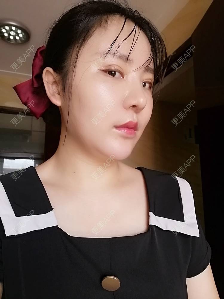 更美 - 静静子子的鼻部多项经验 | 鼻部多项 | 首尔