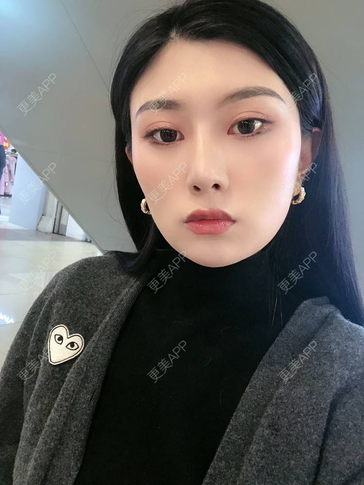 更美 - 更美用户d9XraeiAfE的鼻部多项经验 | 鼻部多项 | 清远