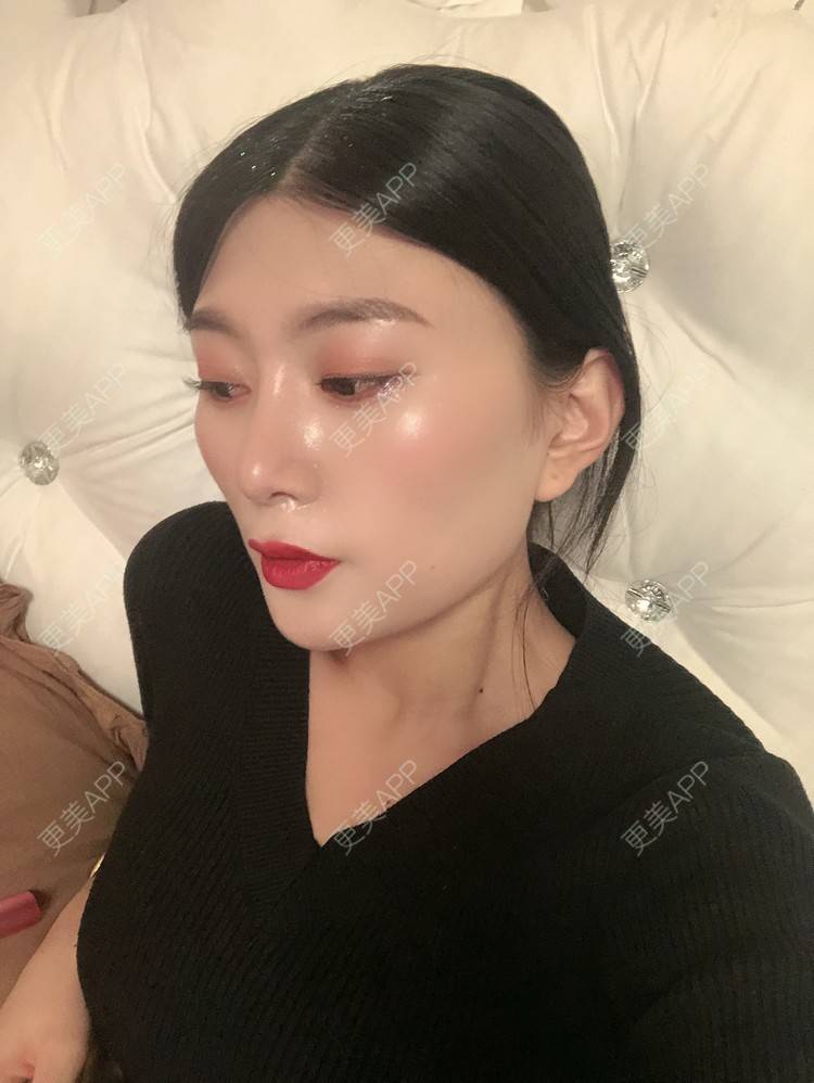 更美 - 更美用户d9XraeiAfE的鼻部多项经验 | 鼻部多项 | 清远