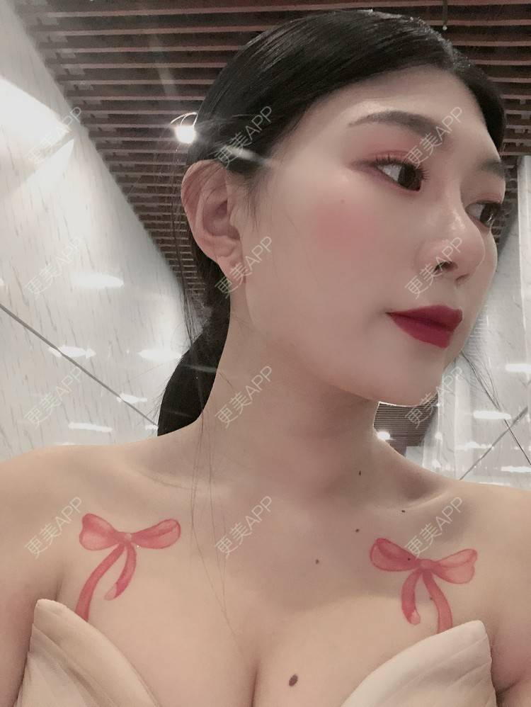 更美 - 更美用户d9XraeiAfE的鼻部多项经验 | 鼻部多项 | 清远