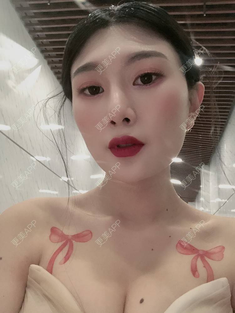 更美 - 更美用户d9XraeiAfE的鼻部多项经验 | 鼻部多项 | 清远