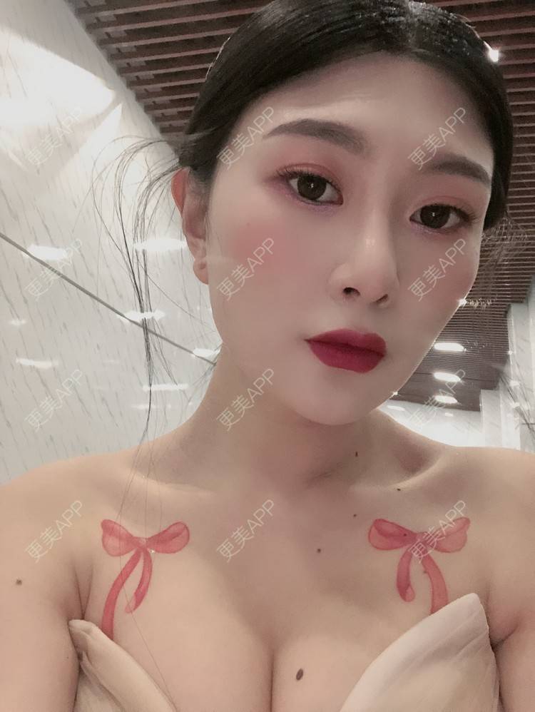 更美 - 更美用户d9XraeiAfE的鼻部多项经验 | 鼻部多项 | 清远