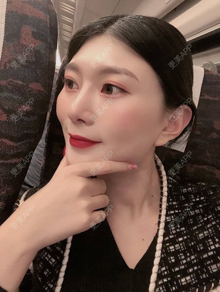 更美 - 更美用户d9XraeiAfE的鼻部多项经验 | 鼻部多项 | 清远