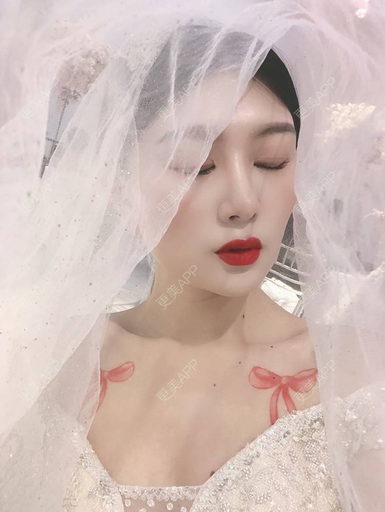 更美 - 更美用户d9XraeiAfE的鼻部多项经验 | 鼻部多项 | 清远