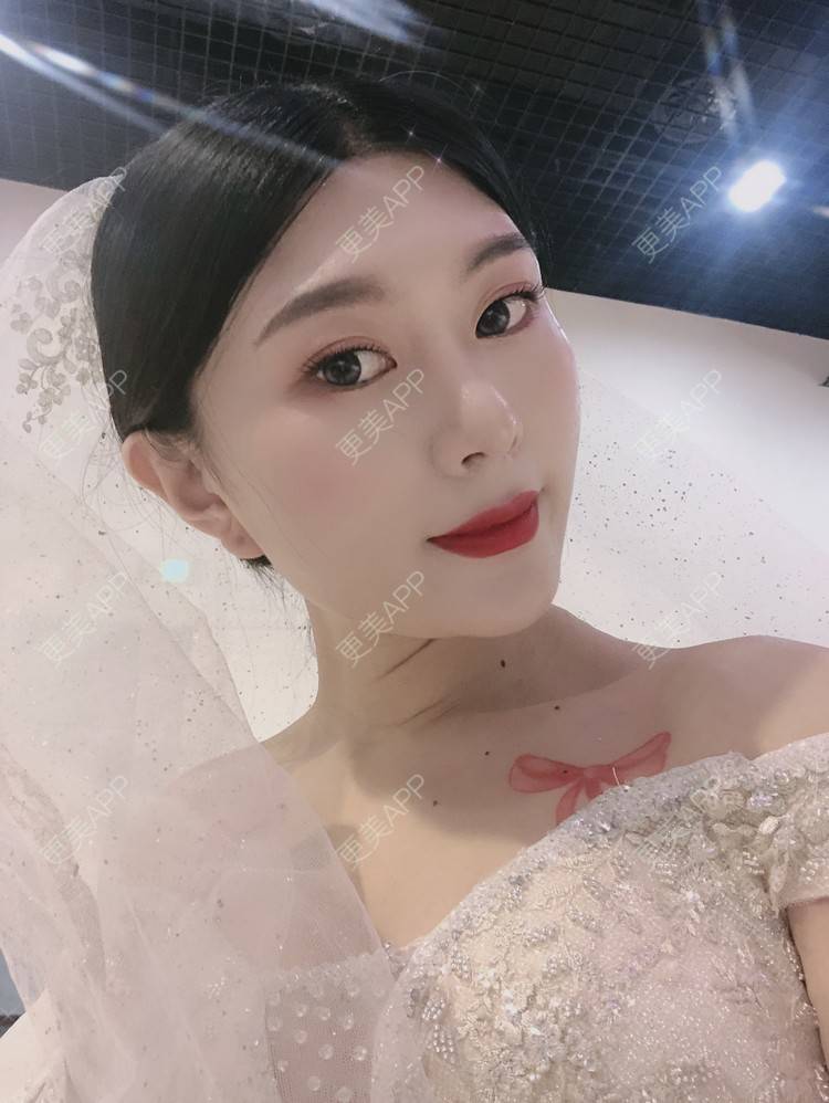 更美 - 更美用户d9XraeiAfE的鼻部多项经验 | 鼻部多项 | 清远