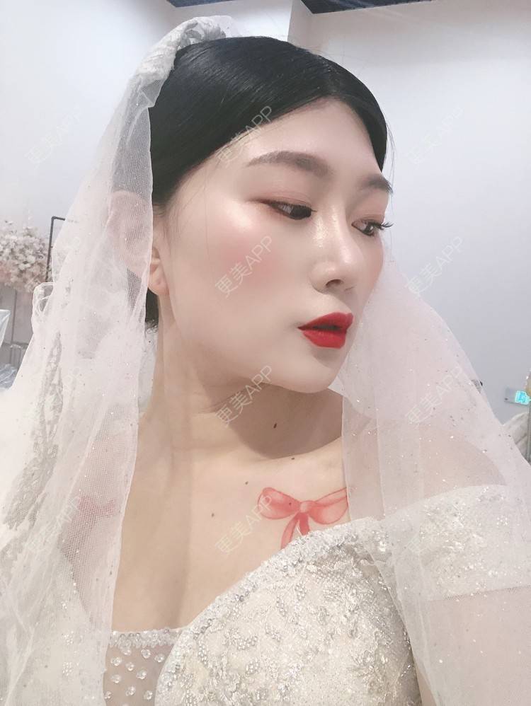 更美 - 更美用户d9XraeiAfE的鼻部多项经验 | 鼻部多项 | 清远