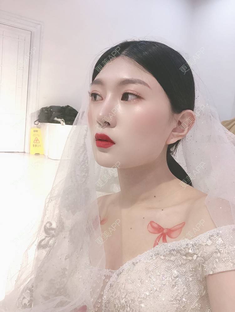 更美 - 更美用户d9XraeiAfE的鼻部多项经验 | 鼻部多项 | 清远