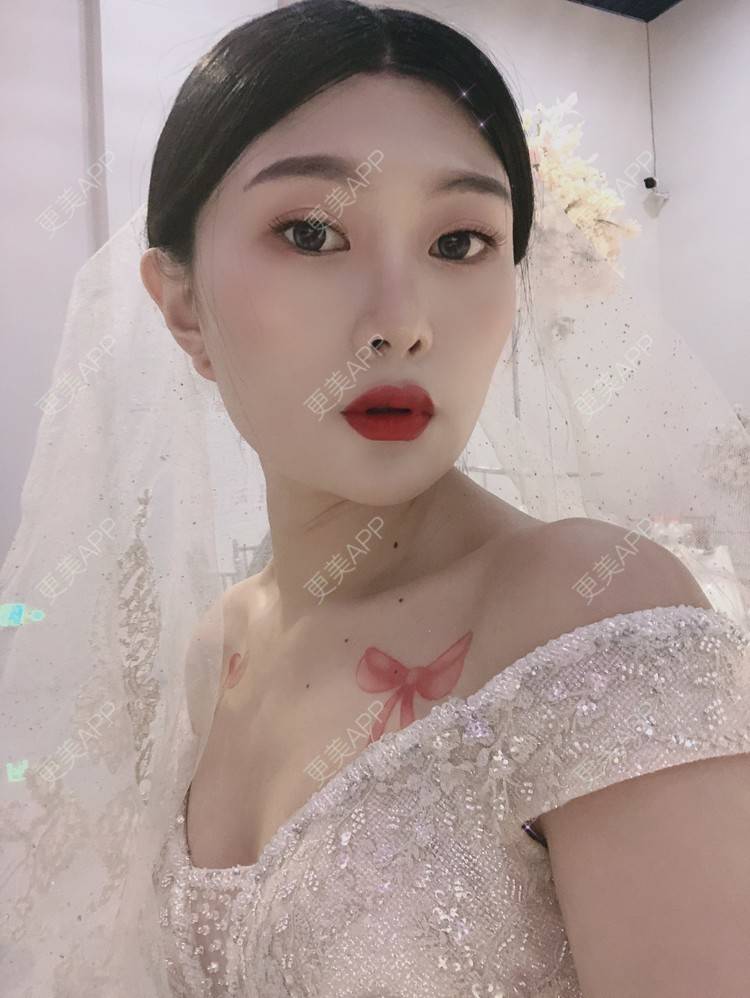 更美 - 更美用户d9XraeiAfE的鼻部多项经验 | 鼻部多项 | 清远