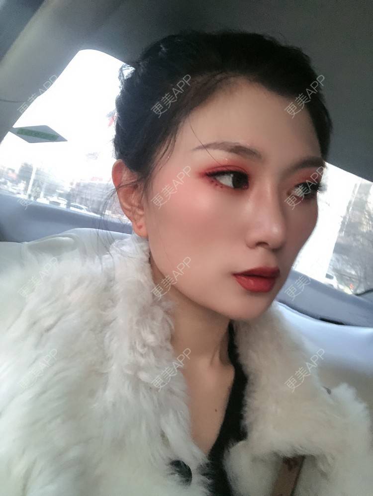 更美 - 更美用户d9XraeiAfE的鼻部多项经验 | 鼻部多项 | 清远