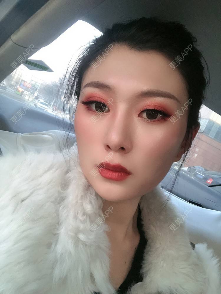 更美 - 更美用户d9XraeiAfE的鼻部多项经验 | 鼻部多项 | 清远